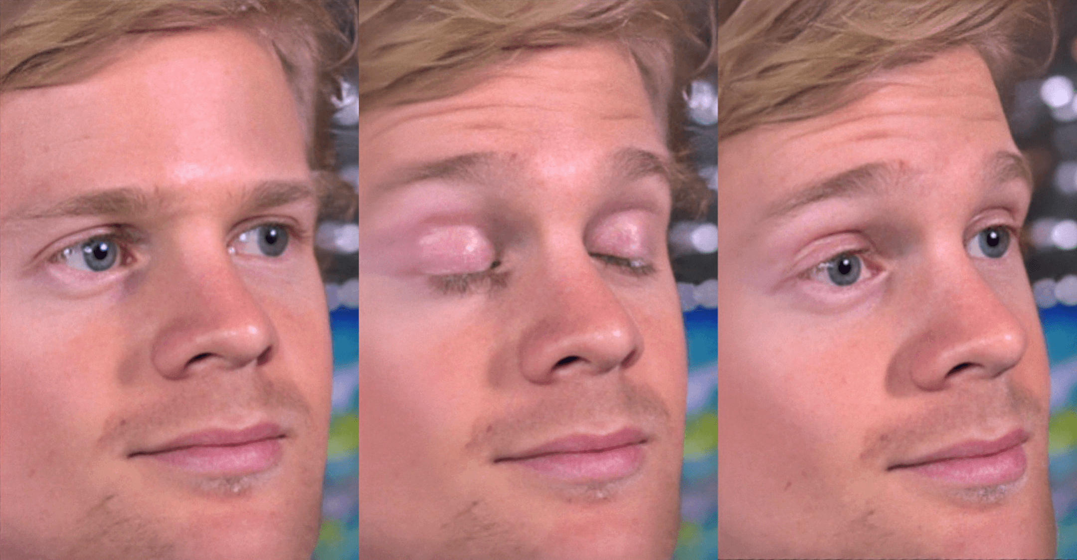 Blinking white guy